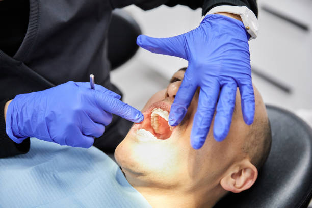 Best Emergency Dental Care for Broken or Chipped Teeth in Laguna Beach, FL